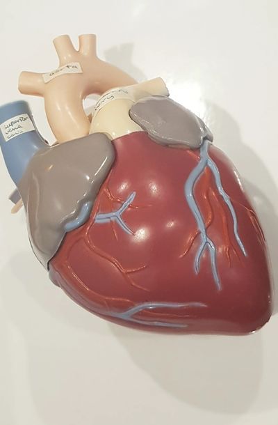 Heart AF Treatment Dr Justin Lim Dr Selina Lim Professor Yoland Lim Health Care Laser JUVEFACE skin