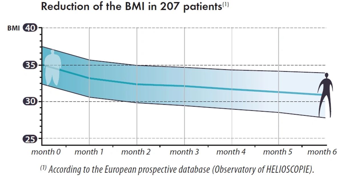 mide balonu ile zayıflama catveli
