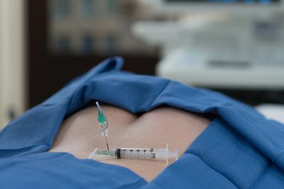 Epidural Steroid Injection for neck and lower back pain at Revive Spine and Pain Care