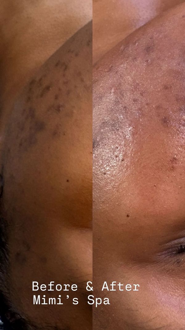 Dark spots in Brookhaven