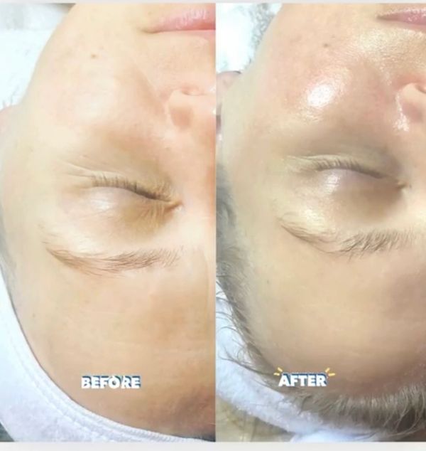 Anti-aging facial near me
Brookhaven, Atlanta