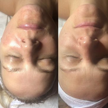 “Anti-aging treatment Brookhaven “