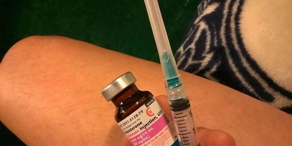 HIV/AIDS testosterone injections for hypogonadism long-term AIDS survivor Bob Bowers Houston Texas