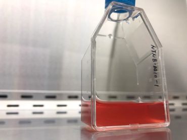 腫瘤免疫細胞治療