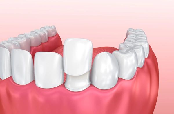 general dental care