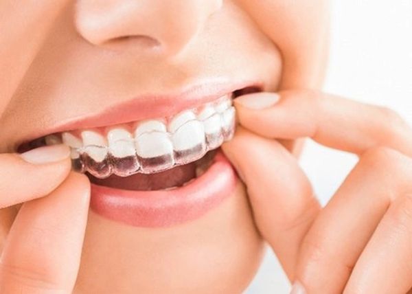 wisdom tooth extraction