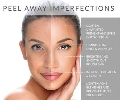 Before and after skin improvement showing reduced imperfections.