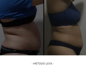 Redução de gordura visceral e metabolismo acelerado