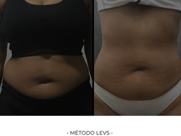 Se perder peso é seu objetivo, faça isso com nosso método de alta performance.