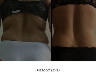 Emagrecimento de alta performance com preservação de massa magra.