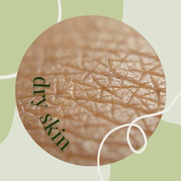 Dry skin, winter care, all natural aloe based with essential oils for extra hydration