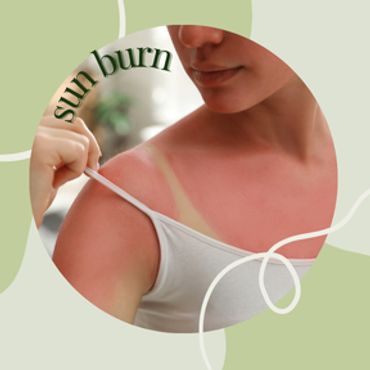 aloe vera skincare to calm redness, reduce inflammation. Perfect for post-sun care, after-beach recovery. Our plant-based remedies use high EWG rated ingredients.. Check out our line of aloe products and our line of natural botanical skincare