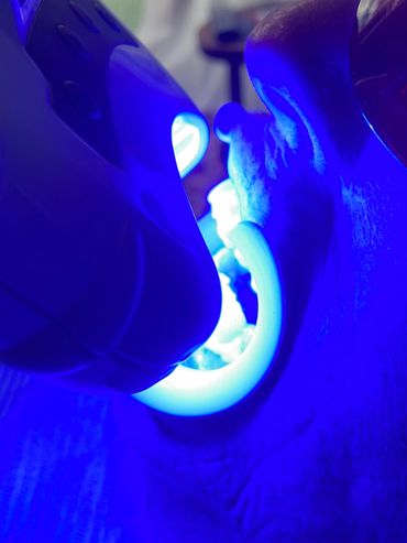 Safe LED light is used, not UV.