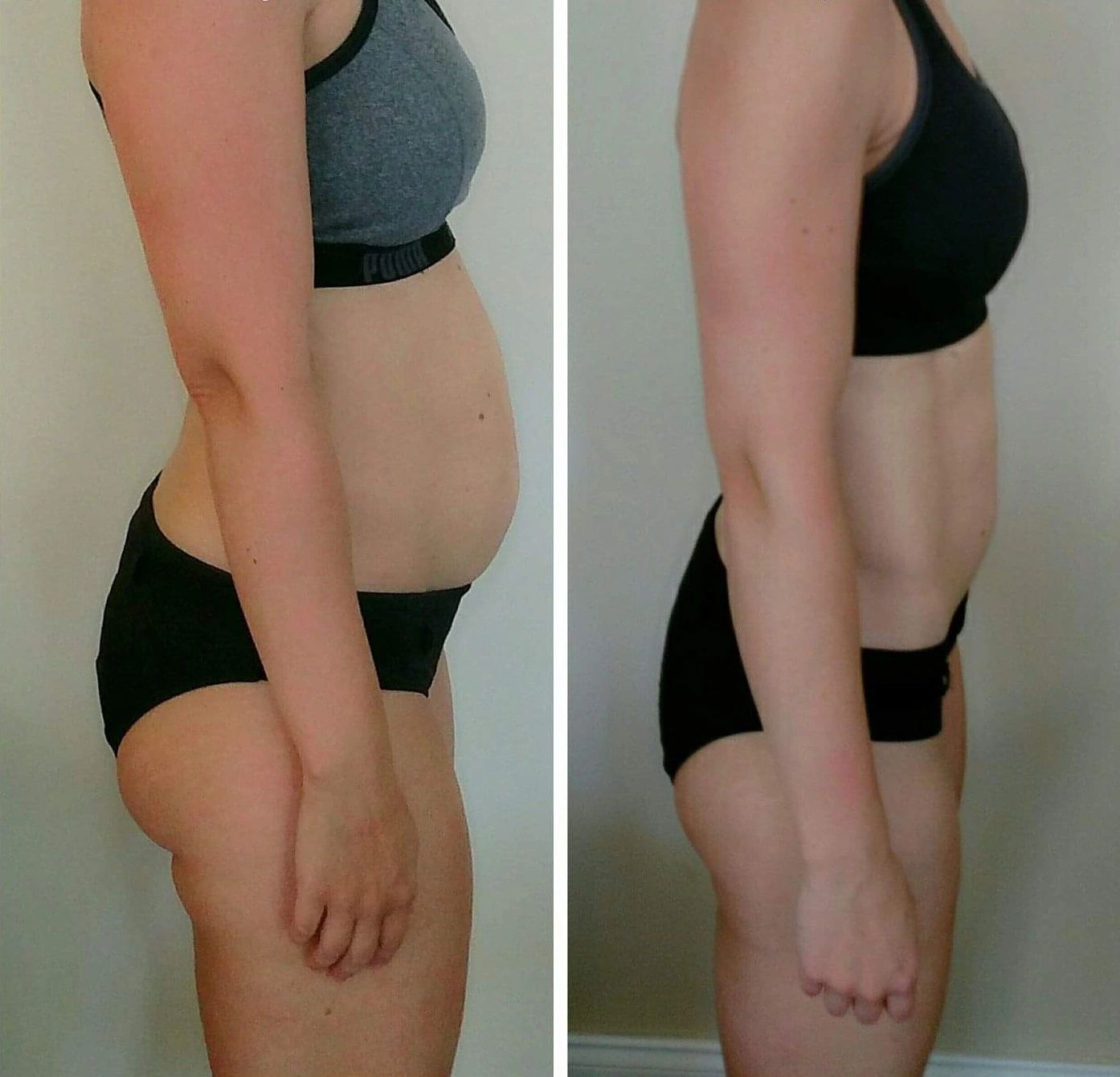 My Before & After Results 2018