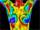 Breast thermography specialist 