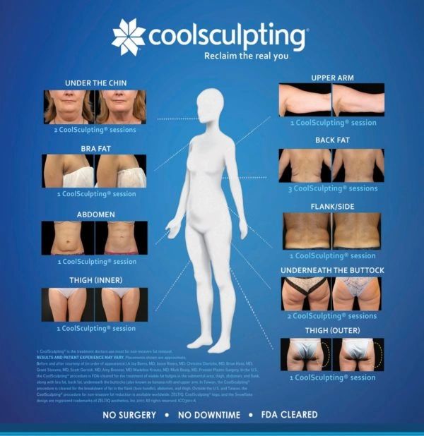 IMED SPA -  coolsculpting