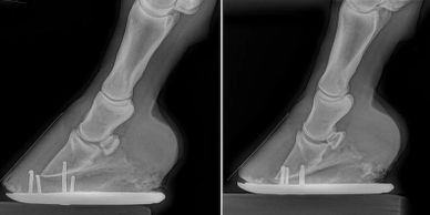 xray