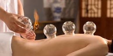Cupping in Charlotte NC
Cupping therapy in Charlotte NC