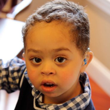 A young boy with MSS looks at the camera with large brown eyes. He is wearing a hearing aid.