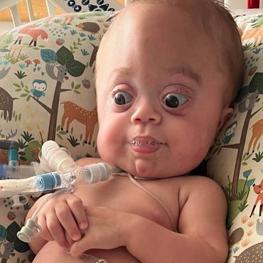 An infant with MSS sits with hands clasped together. He has a trach and ventilator.