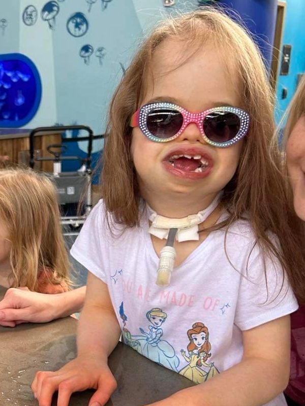 A girl with MSS and a tracheostomy smiles while wearing sparkly sunglasses.