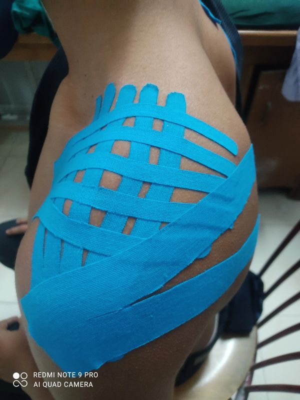 Tapping for shoulder stability.