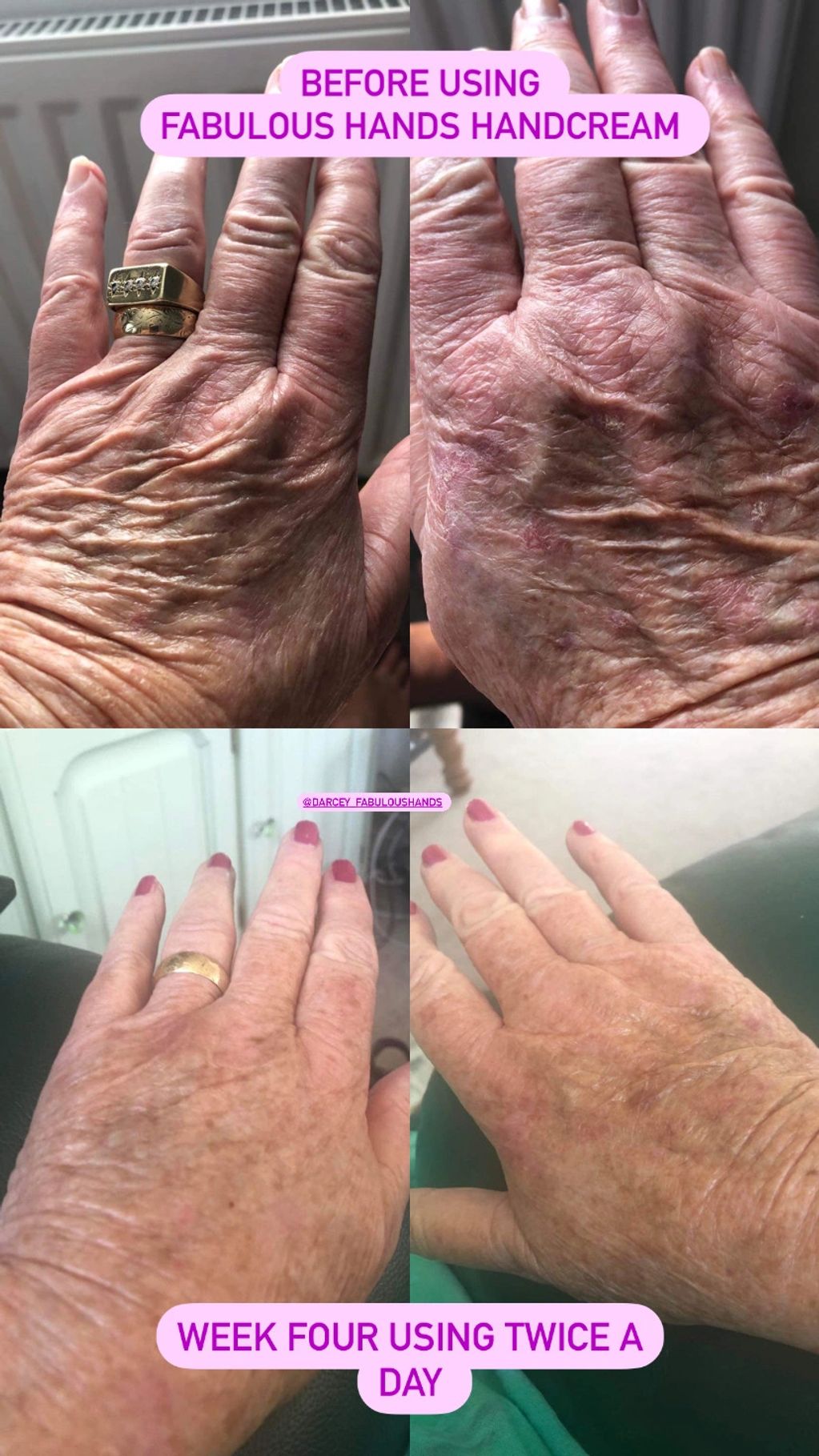 A very willing participant in our 'See the Difference Challenge' use Fabulous Hands just twice a day