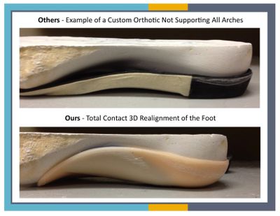 ZFEET Custom Orthotics support your arches
