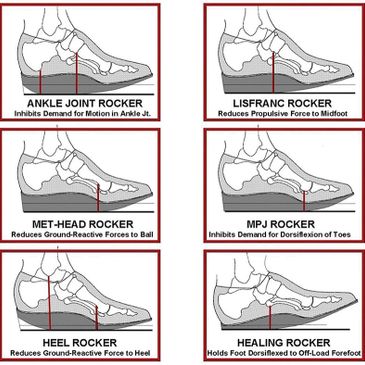 Rocker soles are added to your shoes to further offload painful parts of your feet.