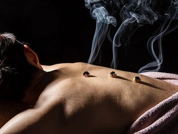 Person receiving moxibustion therapy with smoke rising from the back.