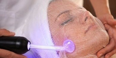 High Frequency current,  Darsonval , high frequency facial Facials, anti-aging, acne
