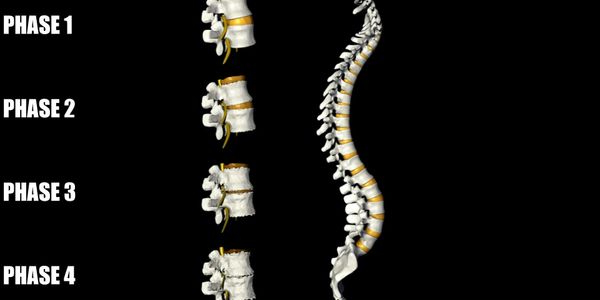 phases of degeneration