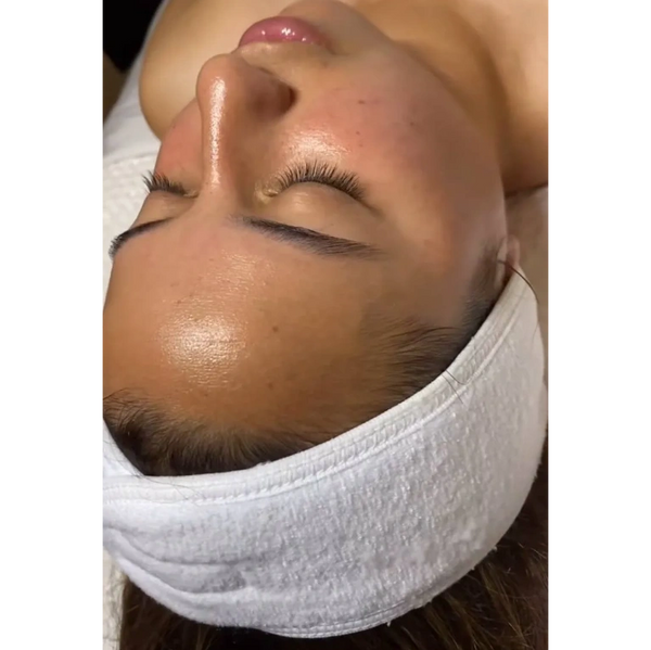 Visible results from CO₂ facial treatment for skin rejuvenation