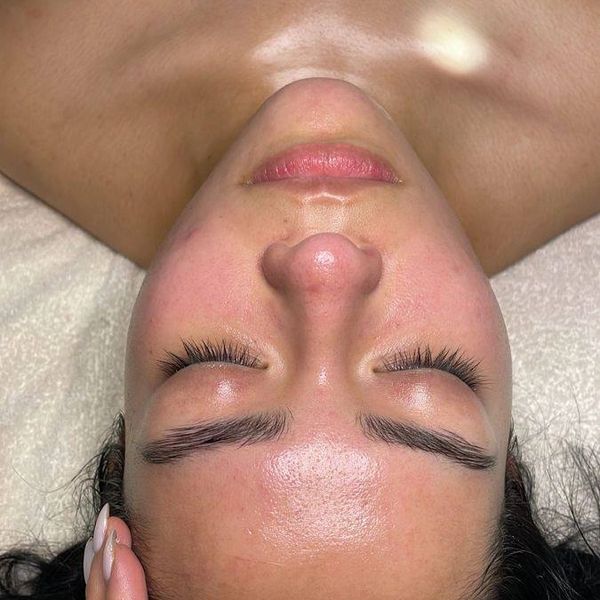 Brightening treatment results: skin with reduced pigmentation