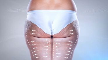 Details where the treatment reduces inch loss, apprearnace of cellulite, smoother & firmer skin