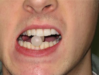 Neuromuscular reeducation and exercises for patient treatment