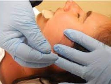 Treatment for patient undergoing intramuscular dry needling