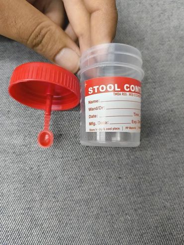Stool container with attached spoon, secure screw seal, and clear medical-grade labeling