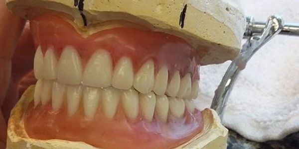 Dentures in Kokomo, Affordable Dentures, Medicaid Dentures, Dentures, Partials, Cheap dentures, LADD