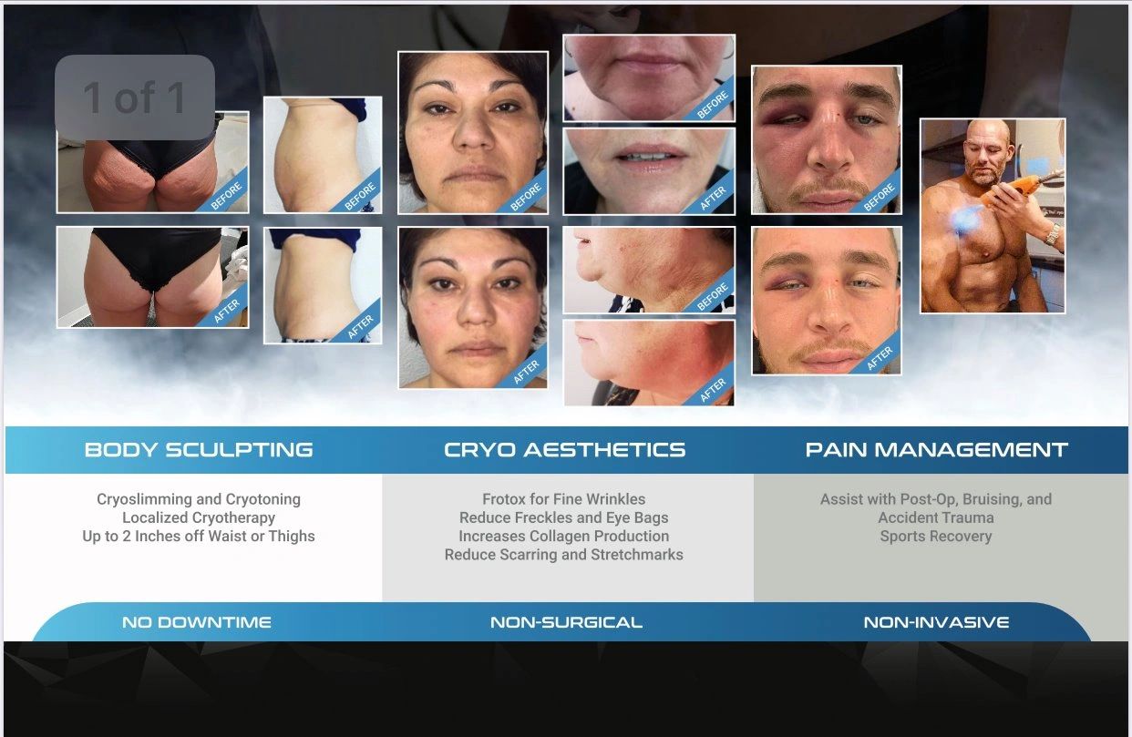 Cellulite reduction, Cellulite removal, Fat freezing, Cool Sculpting, Laser lipo, lipo suction