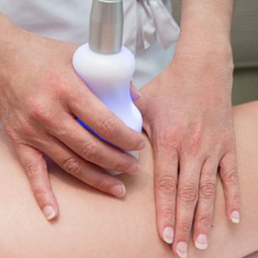 Cellulite reduction, Cellulite removal, Fat freezing, Cool Sculpting, Laser lipo, lipo suction