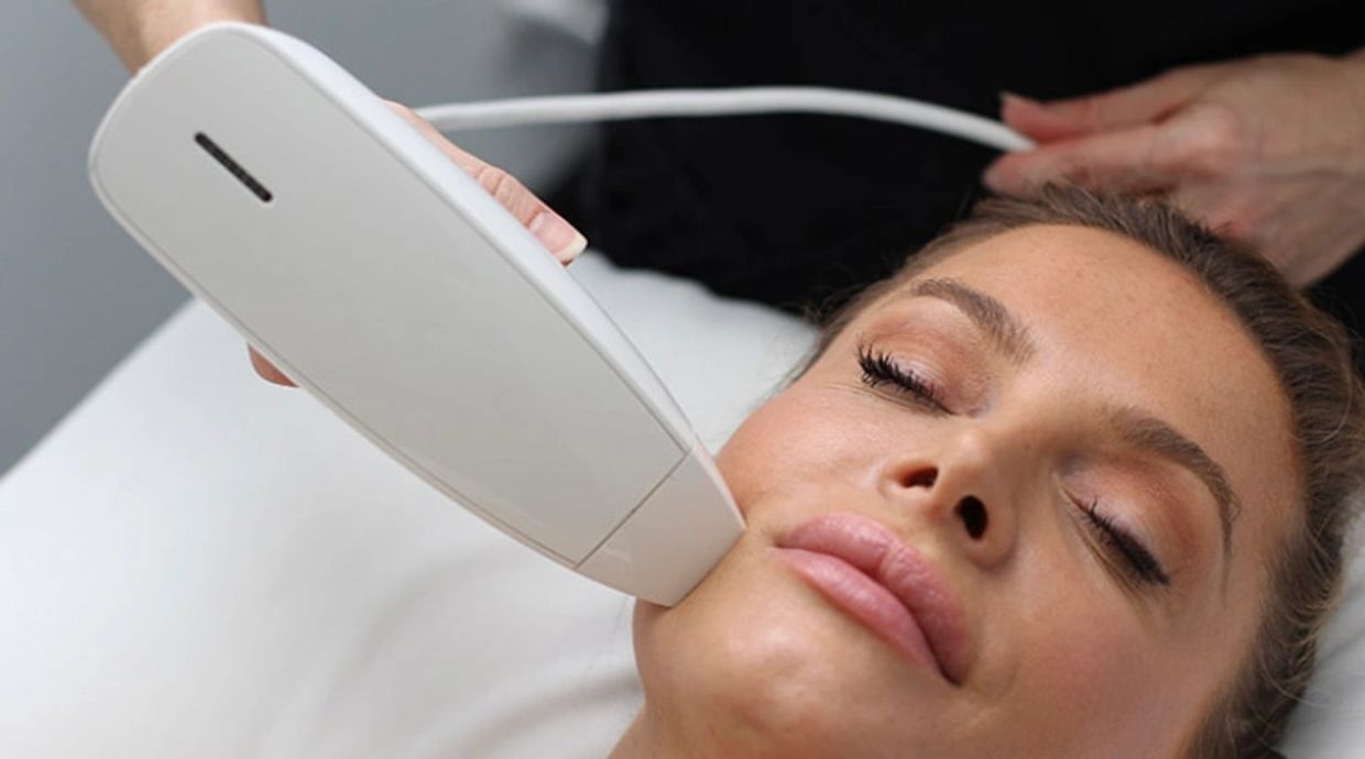 Skin resurfacing treatments, radio frequency, correct scars, stretch marks, acne, skin tightening