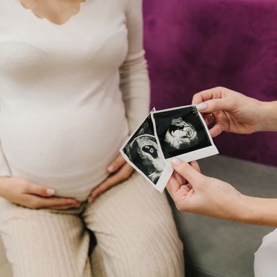 A pregnant woman holding a printed ultrasound image.