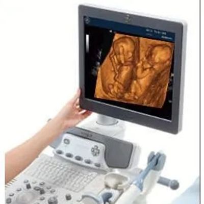 An ultrasound machine displaying a detailed image on its screen.