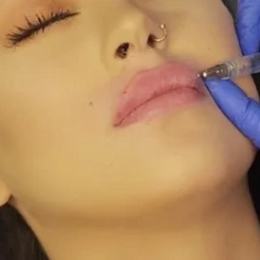 A woman receiving a lip injection with closed eyes.