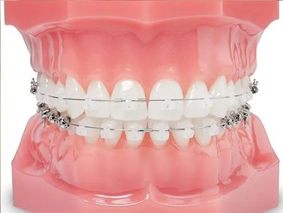 best implants in chandigarh