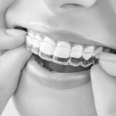 Best Invisaligners in Chandigarh