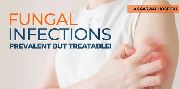 Fungal infection develops in damp body areas, commonly on foot or armpit. These infections are conta