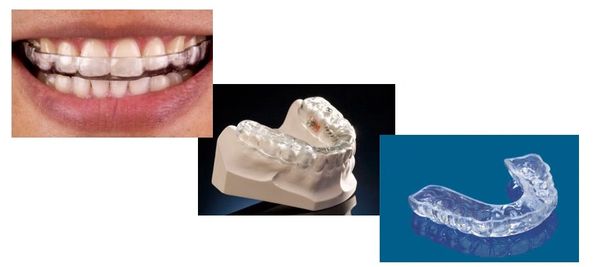 guardas o protectores nocturnos