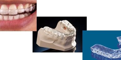 guarda oclusal mejor clínica dental monterrey  best dental clinic mouth guard mexico 